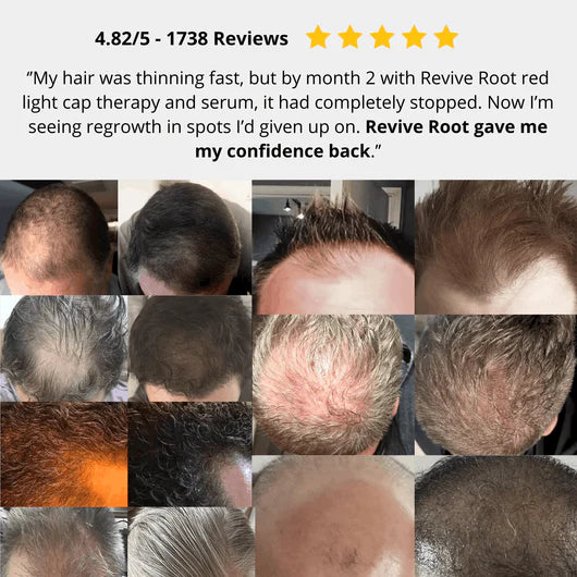 Red Light Therapy Cap